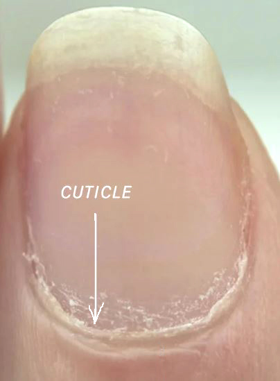 عکس کوتیکول ناخن